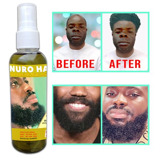 Hair Growth Oil - 100ml ( Nnuro Hair Food )